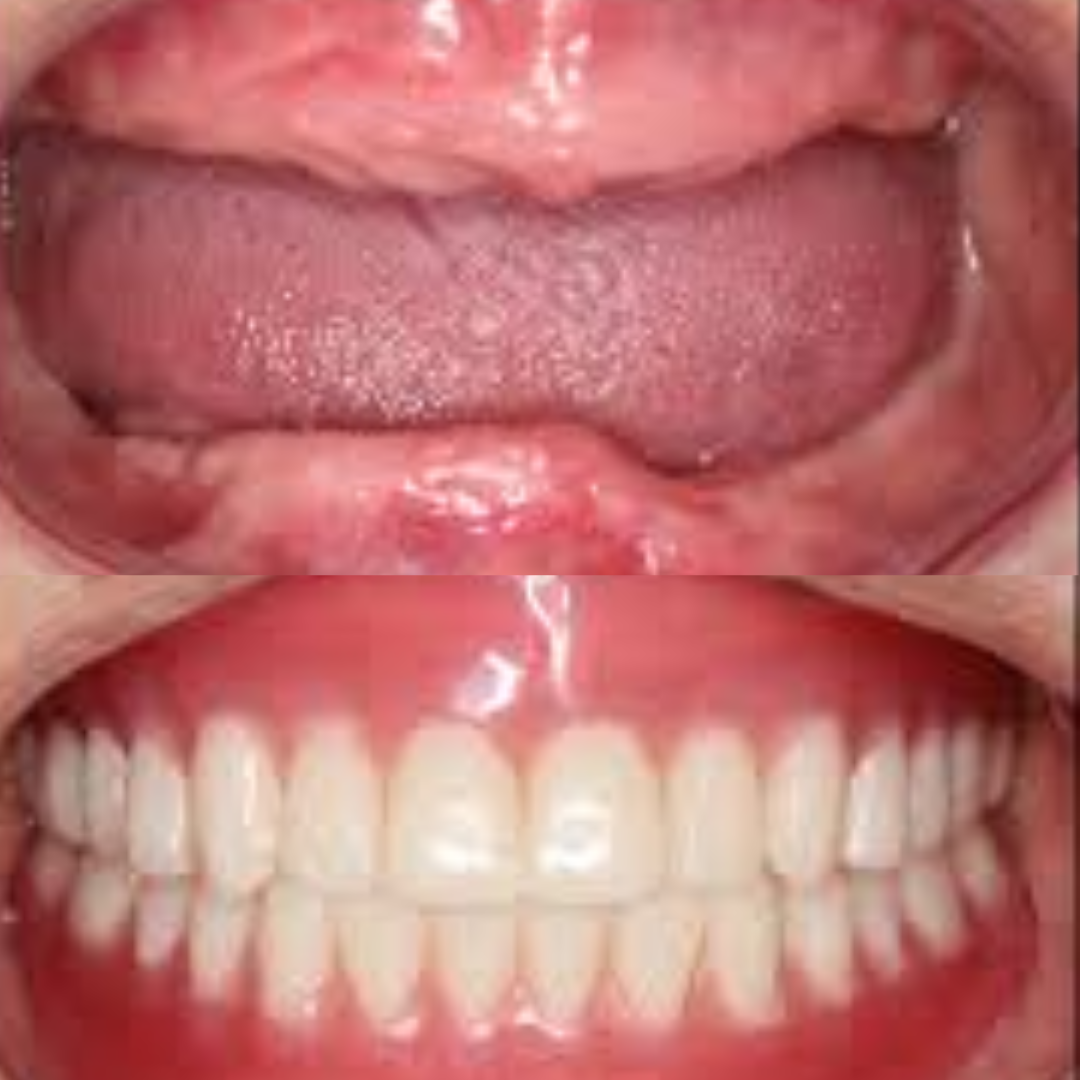 dental impamnt (1)