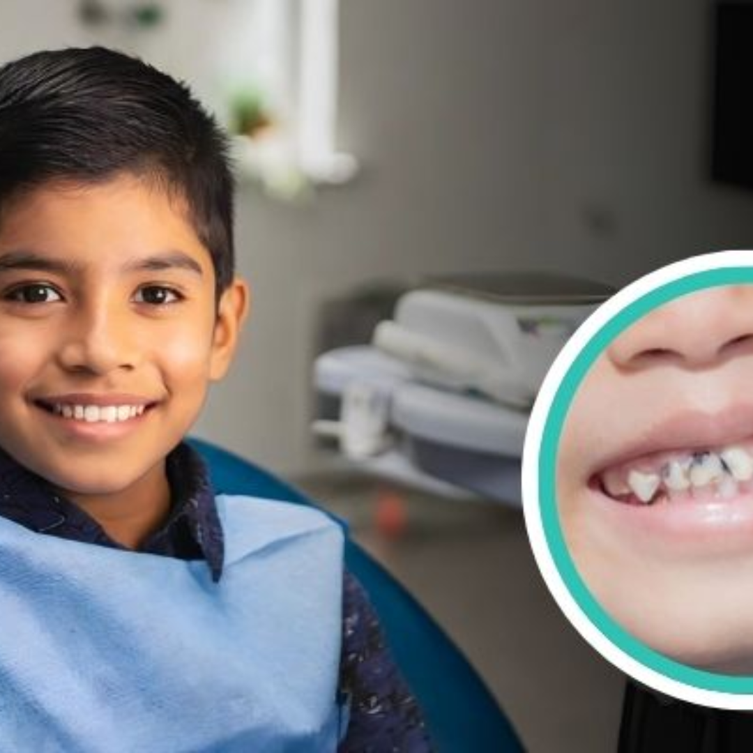 dental impamnt (3)