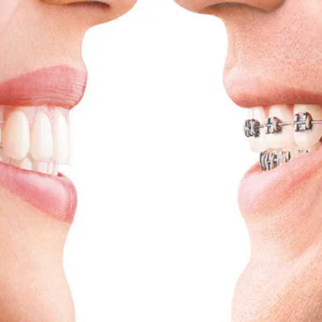 dental impamnt (4)