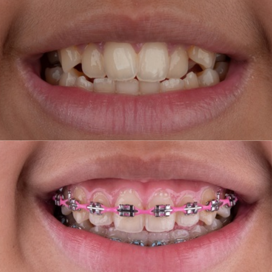 shree dental clinic (11)