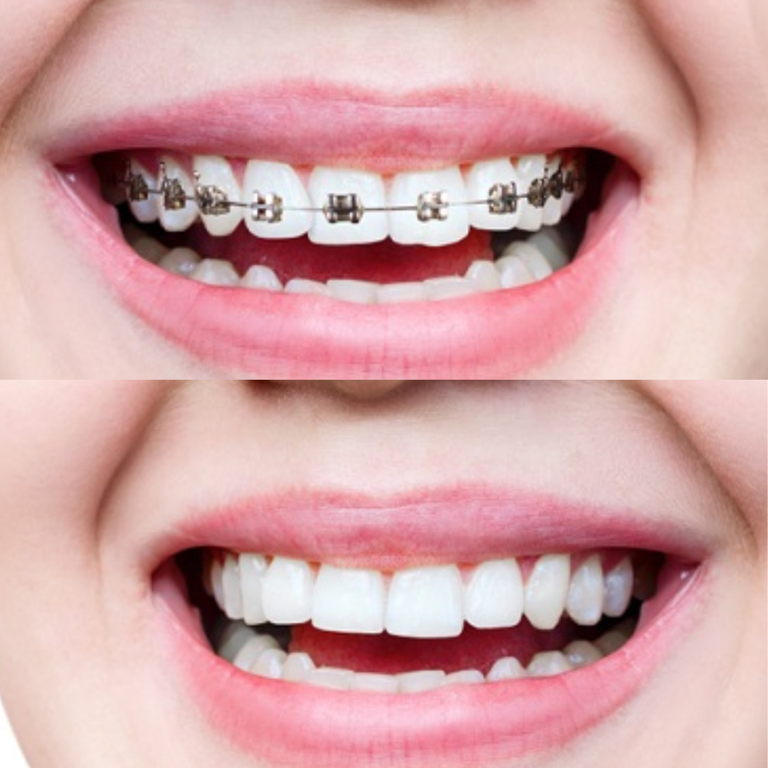 shree dental clinic (12)