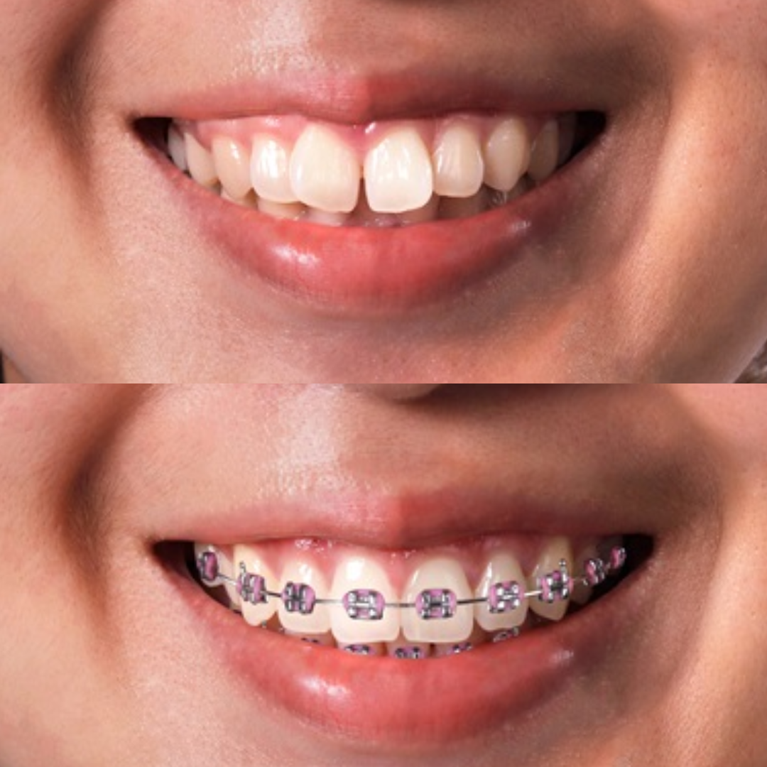 shree dental clinic (13)