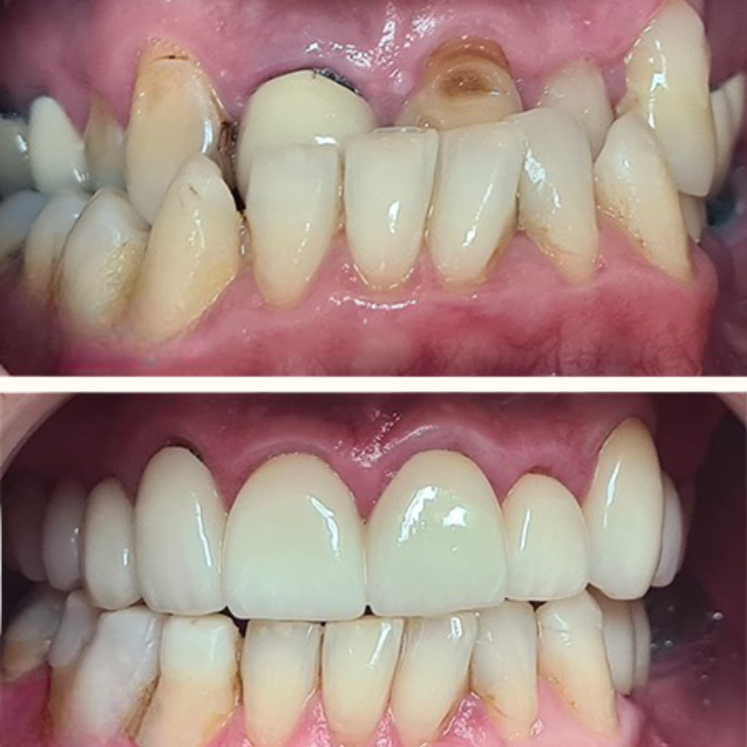 shree dental clinic (14)