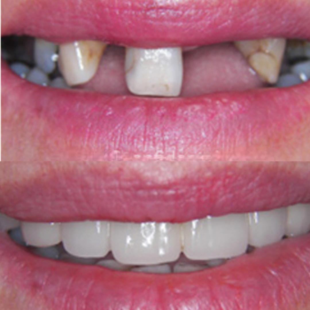 shree dental clinic (15)