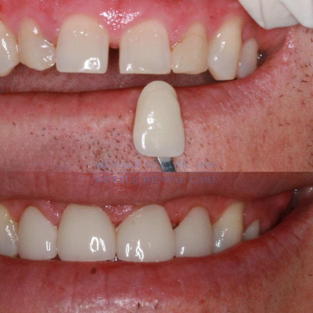 shree dental clinic (16)