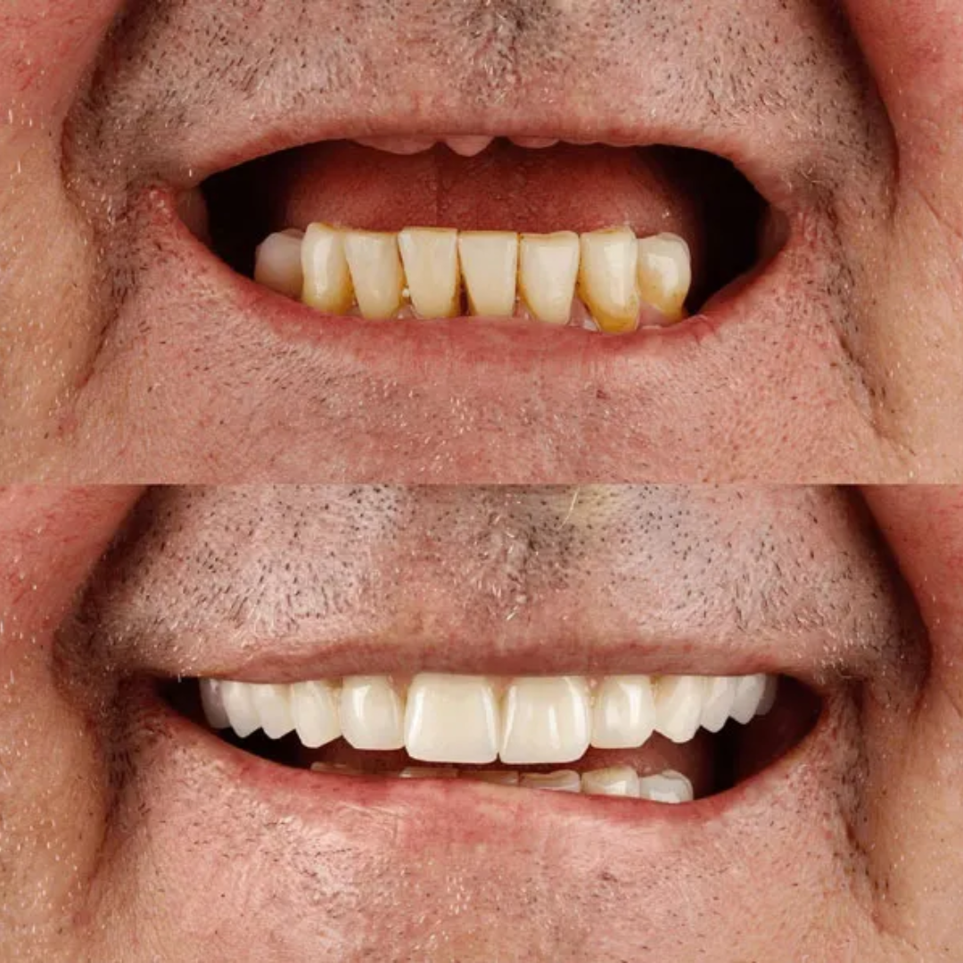 shree dental clinic (17)