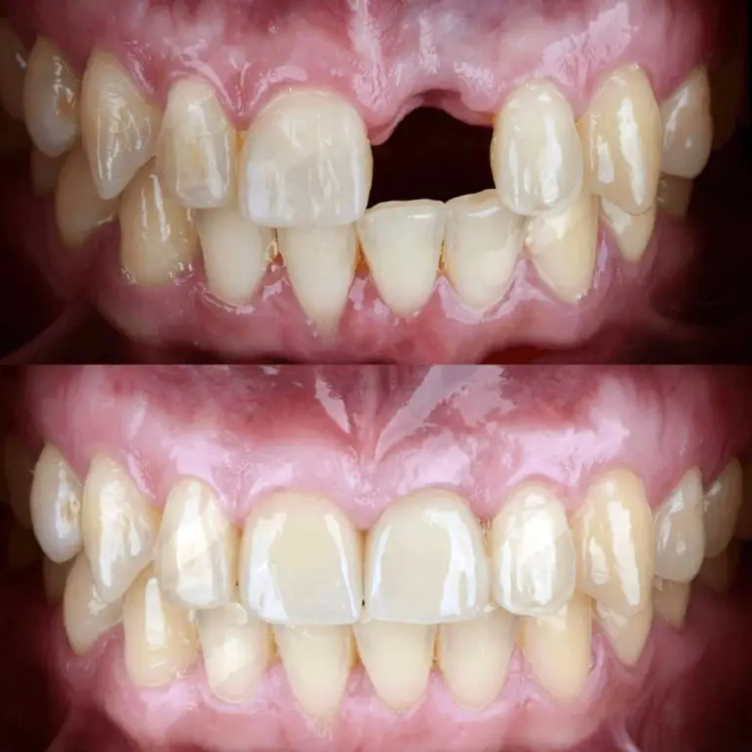 shree dental clinic (18)