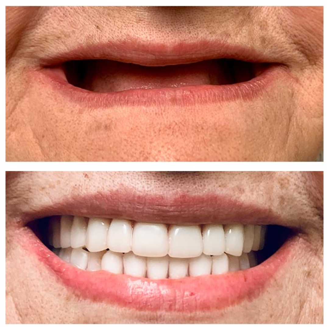shree dental clinic (19)