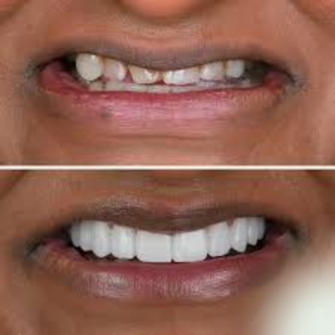 shree dental clinic (20)