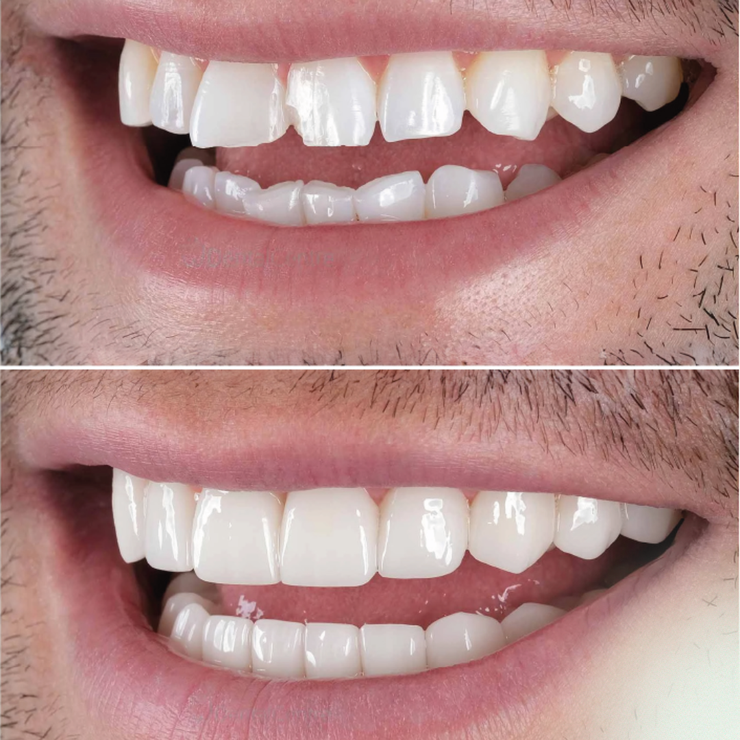 shree dental clinic (22)