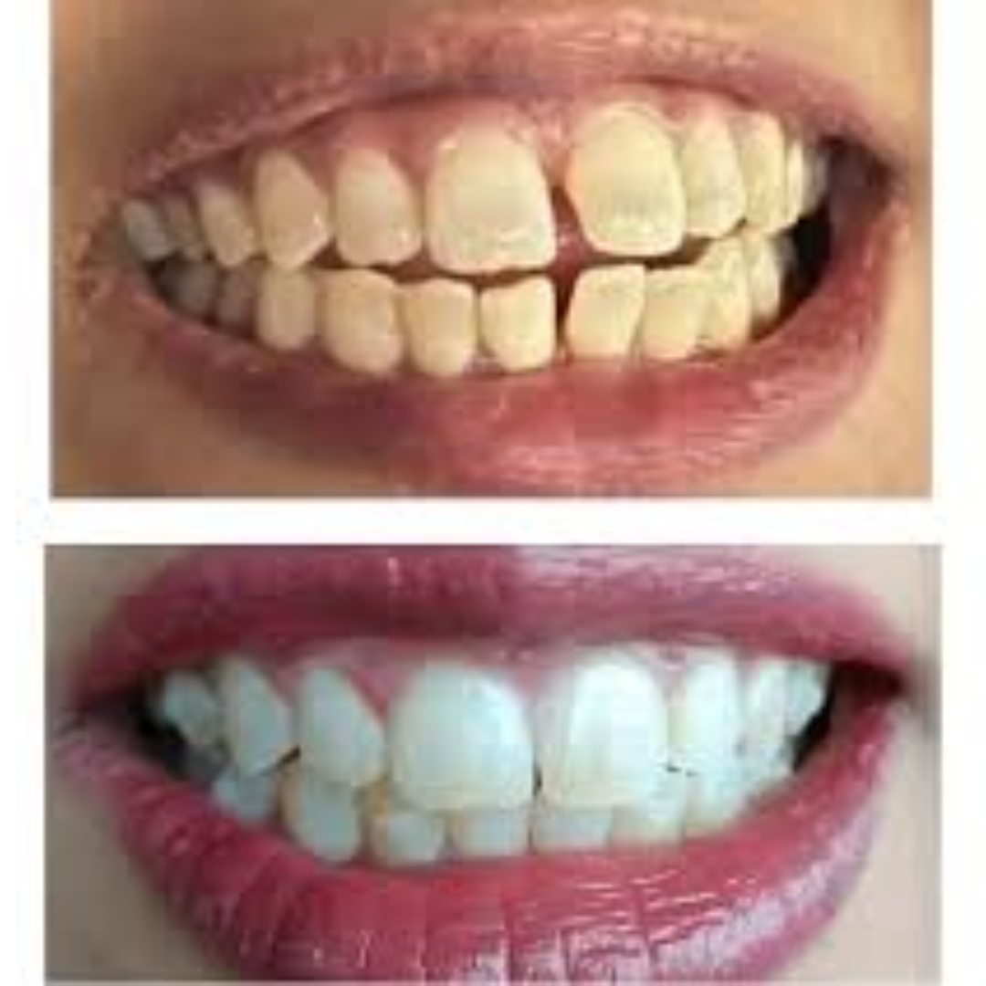 shree dental clinic (26)