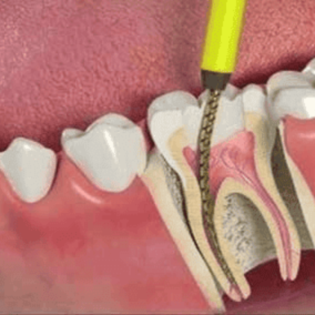 shree dental clinic (29)