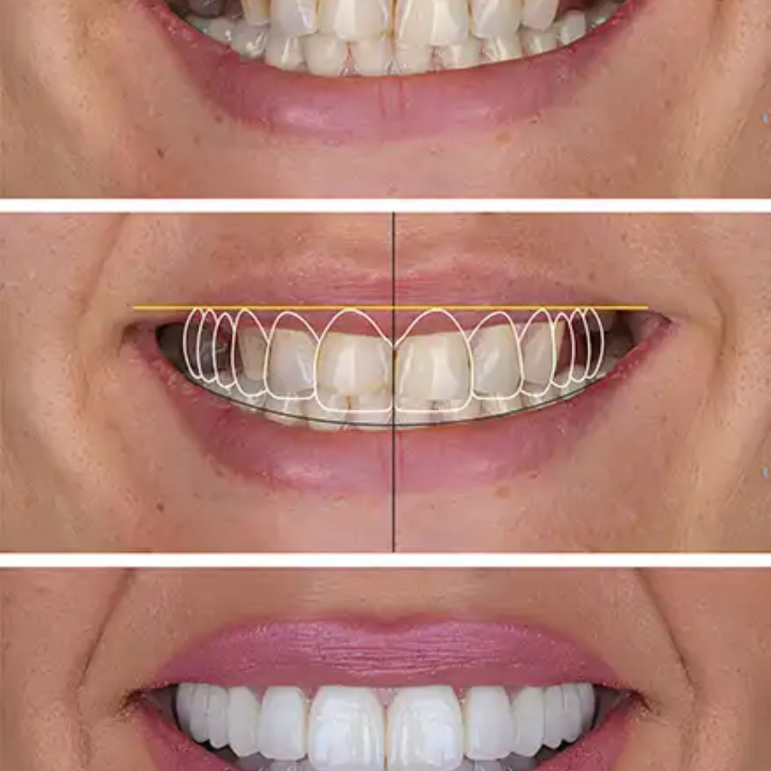 shree dental clinic (31)