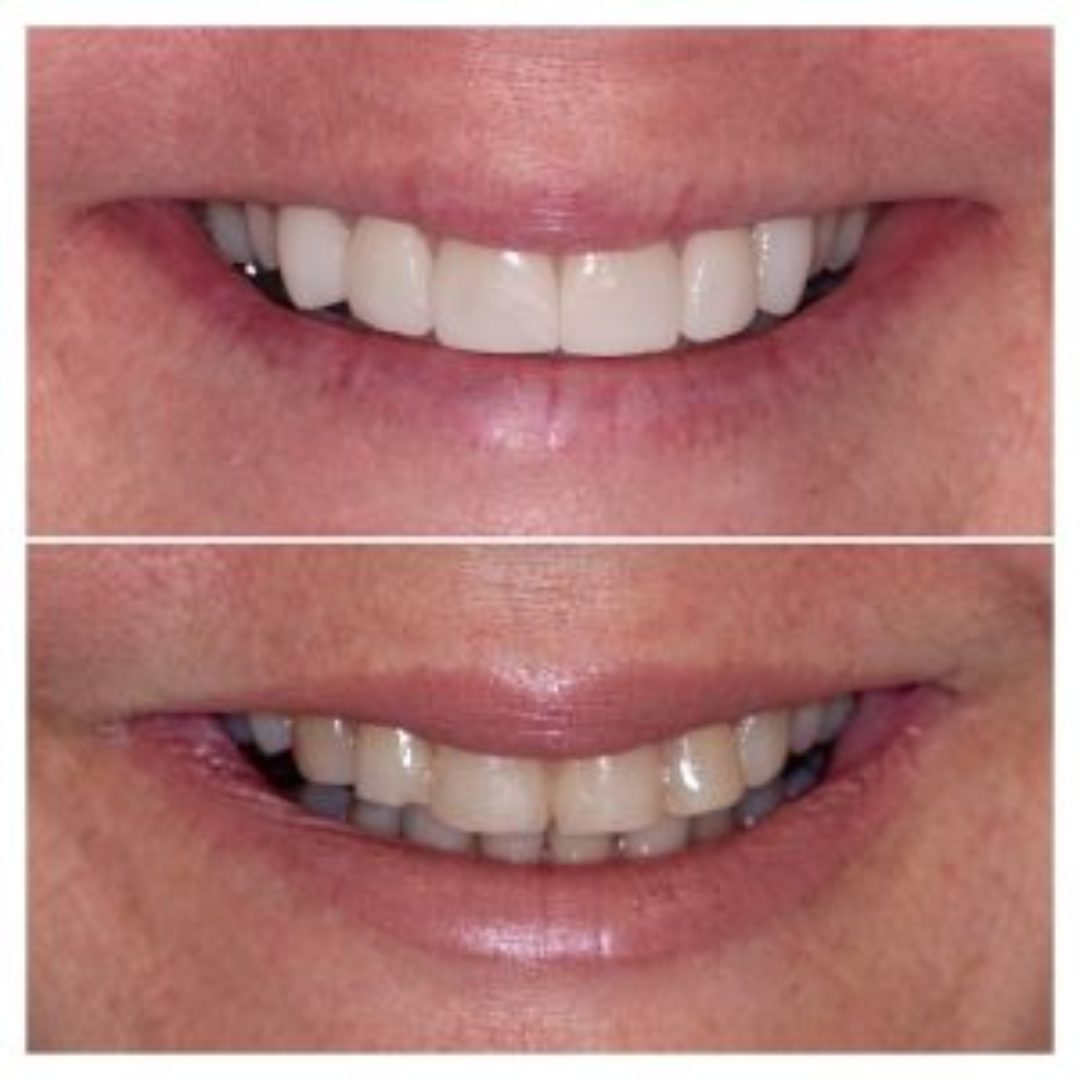 shree dental clinic (32)