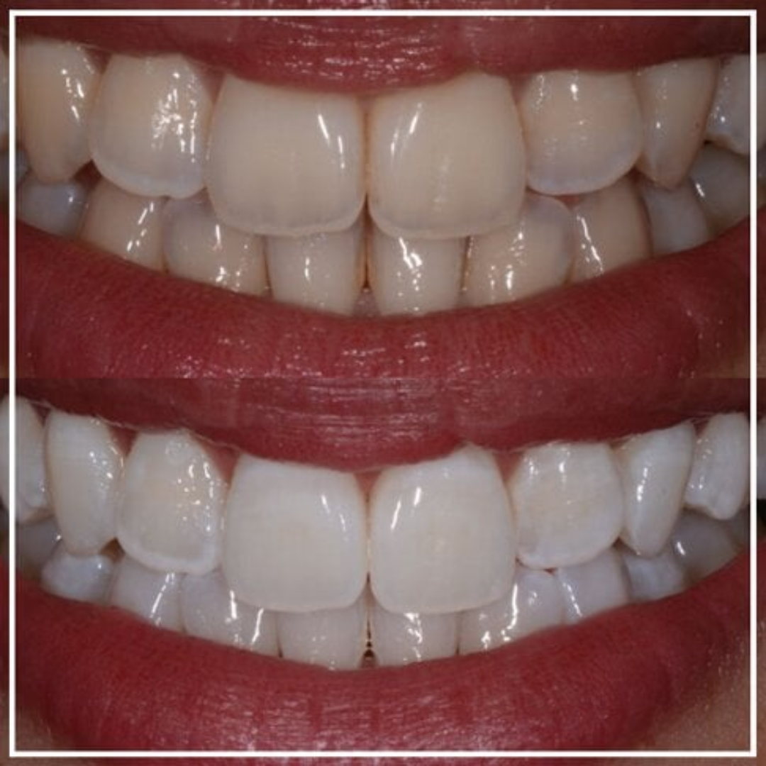 shree dental clinic (33)