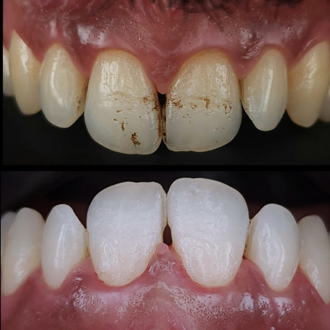 shree dental clinic (34)