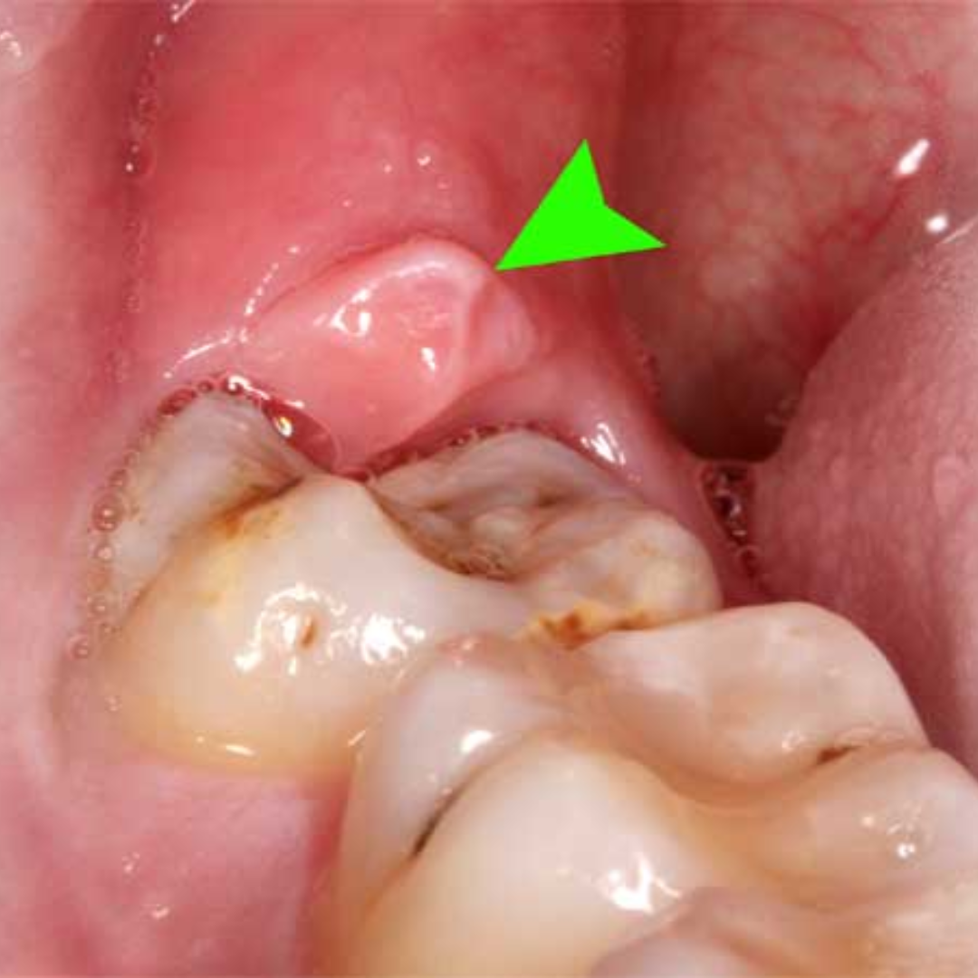 shree dental clinic (35)