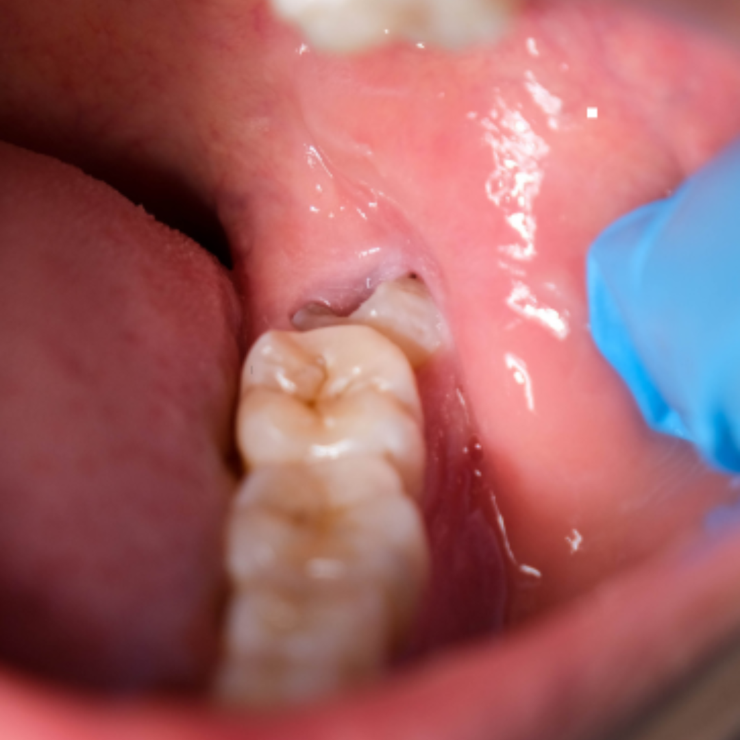 shree dental clinic (36)
